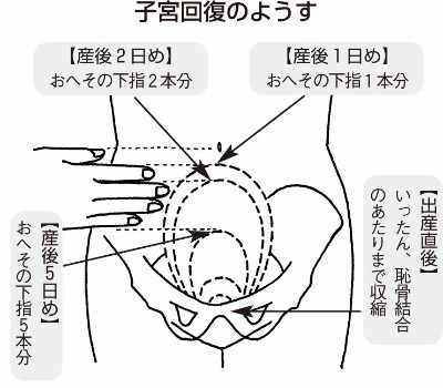 看護学生です 現在実習で 帝王切開を受けた褥婦を受け持っています Yahoo 知恵袋