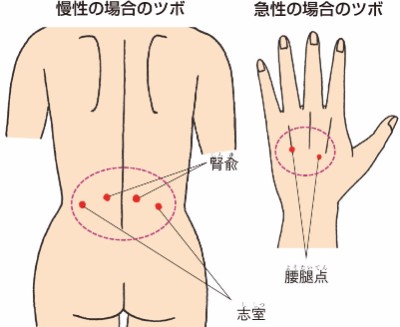 大腸 兪 押す と 痛い