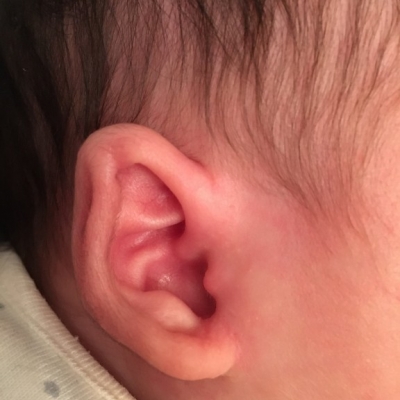 生後1カ月 耳の形 子育て期 生後0ヶ月 1ヶ月 2ヶ月 3ヶ月 4ヶ月 ベビカム相談室 ベビカム