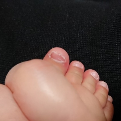 足を床に叩きつけて爪がボロボロです 子育て期 生後5ヶ月 6ヶ月 7ヶ月 8ヶ月 9ヶ月 ベビカム相談室 ベビカム