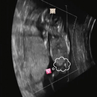 エコー写真です 性別判断について 妊娠初期 1ヶ月 2ヶ月 3ヶ月 4ヶ月 ベビカム相談室 ベビカム エコー写真です 性別判断について 妊娠初期 1ヶ月 2ヶ月 3ヶ月 4ヶ月 ベビカム相談室 ベビカム