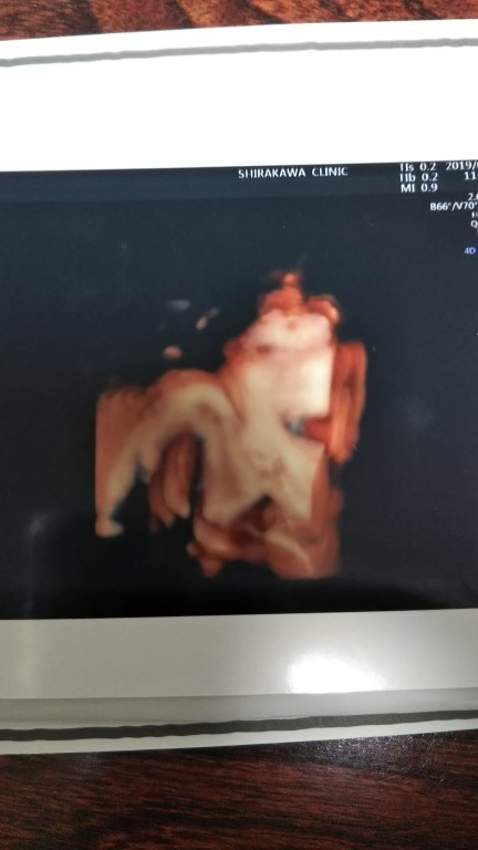 妊娠10ヶ月 妊娠36週 37週 38週 39週 妊娠後期 の超音波写真 妊娠 出産 育児に関する総合情報サイト ベビカム
