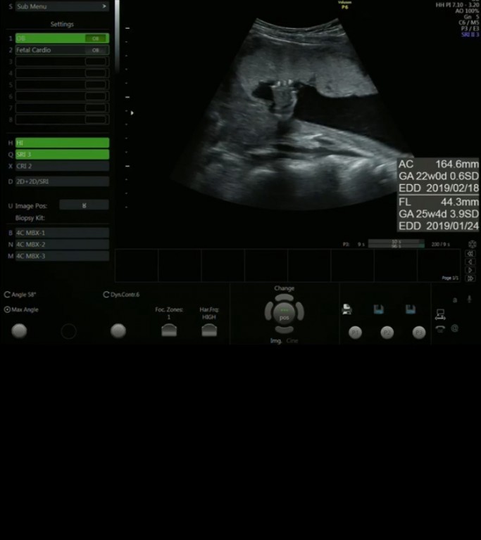 妊娠9ヶ月 妊娠32週 33週 34週 35週 妊娠後期 の超音波写真 妊娠 出産 育児に関する総合情報サイト ベビカム