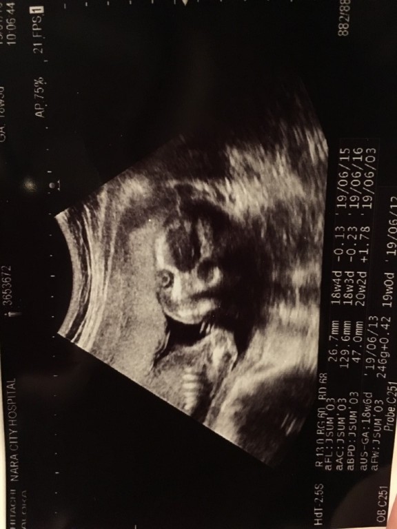 妊娠5ヶ月 妊娠16週 17週 18週 19週 妊娠中期 の超音波写真 妊娠 出産 育児に関する総合情報サイト ベビカム