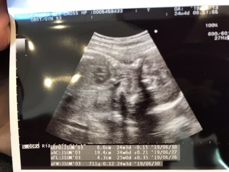 だんだん大きくなってきた ID:9301 妊娠7ヶ月（24週4日）の写真