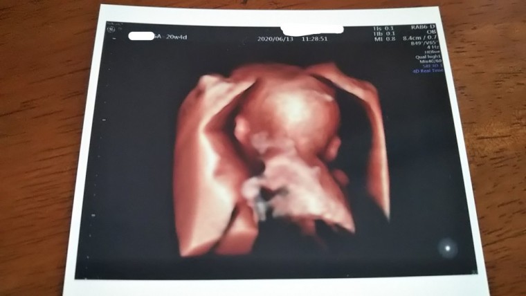 顔隠してあそこ隠さず ID:10619 妊娠6ヶ月（20週4日）の写真