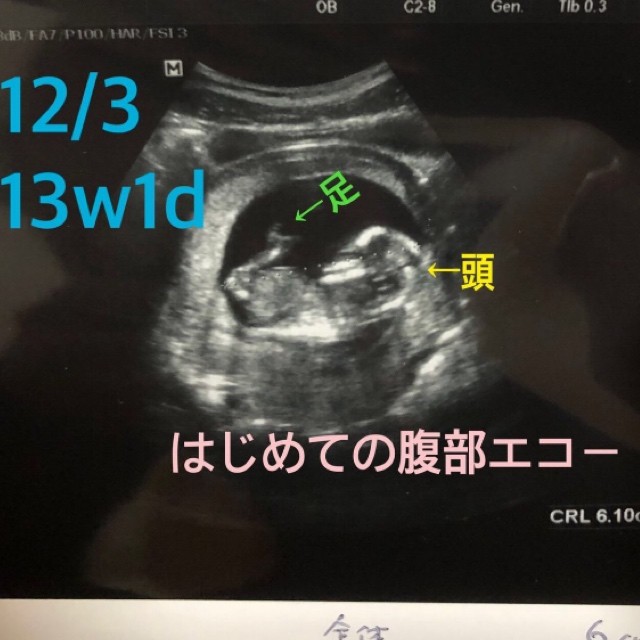  ID:10131 妊娠4ヶ月（13週1日）の写真