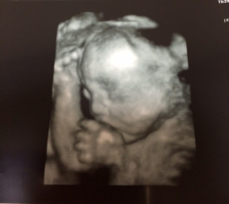 妊娠7ヶ月 妊娠24週 25週 26週 27週 妊娠中期 の超音波写真 妊娠 出産 育児に関する総合情報サイト ベビカム