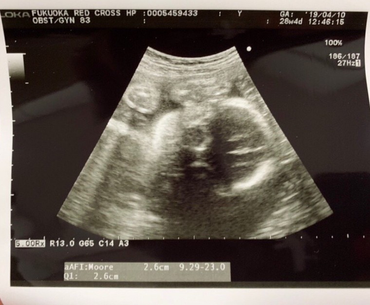 胎動が……！ ID:9302 妊娠8ヶ月（28週4日）の写真