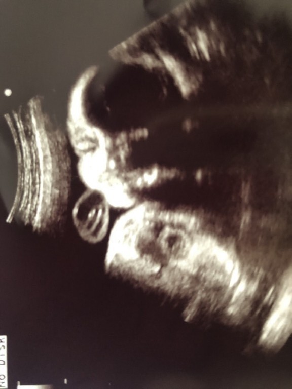 妊娠7ヶ月 妊娠24週 25週 26週 27週 妊娠中期 の超音波写真 妊娠 出産 育児に関する総合情報サイト ベビカム