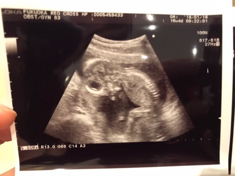 赤ちゃんらしくなってる 妊娠5ヶ月 16週4日 の写真 ベビカム成長記録 妊娠 出産 育児に関する総合情報サイト ベビカム