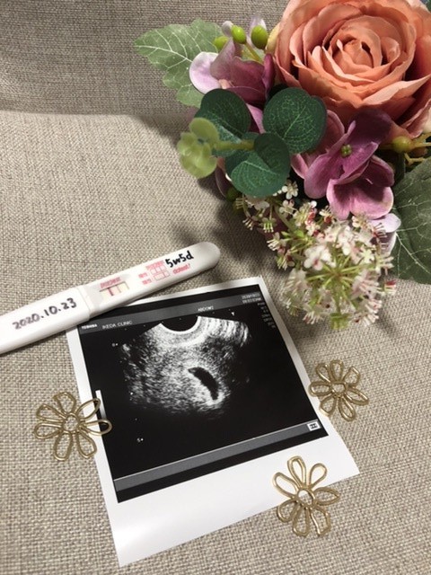 胎嚢確認！ ID:10670 妊娠2ヶ月（5週5日）の写真