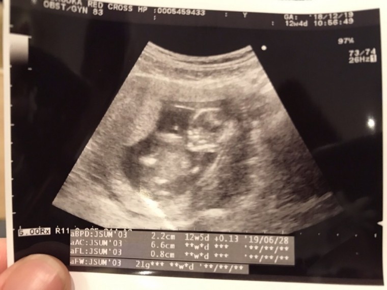 前より大きくなってる ID:9297 妊娠4ヶ月（12週5日）の写真