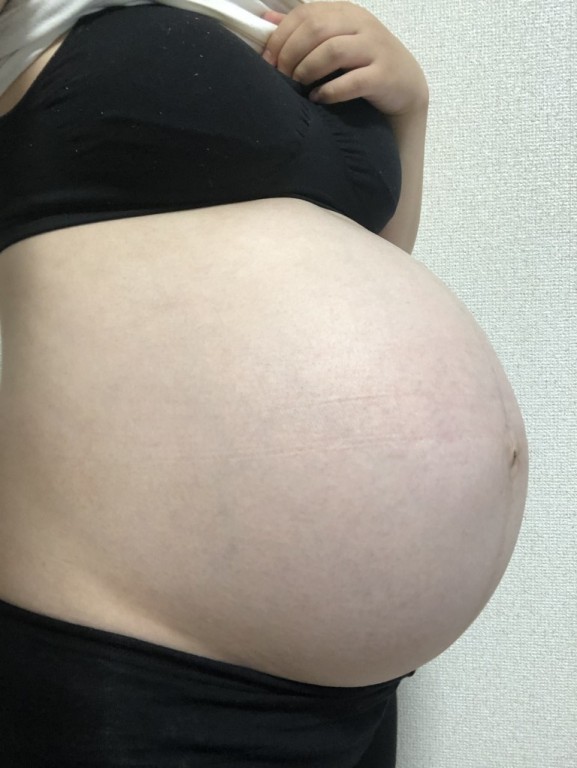 お腹ぱんぱんです 妊娠10ヶ月 36週0日 の写真 ベビカム成長記録 妊娠 出産 育児に関する総合情報サイト ベビカム