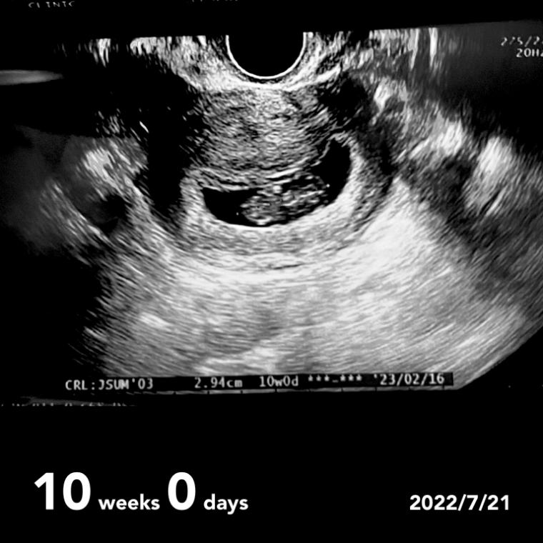出産予定日2/16 ID:10812 妊娠3ヶ月（10週0日）の写真