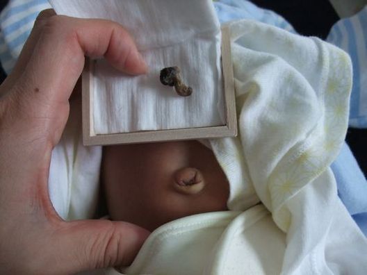 脱 へその緒 生後18日目 日記 こみさんさんのブログ 妊娠 出産 育児に関する総合情報サイト ベビカム 脱 へその緒 生後18日目 日記 こみさんさんのブログ 妊娠 出産 育児に関する総合情報サイト ベビカム