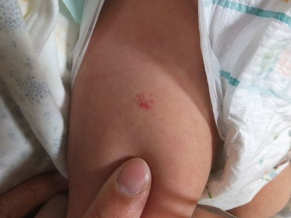 セイちゃんの１ヵ月検診 日記 こみさんさんのブログ 妊娠 出産 育児に関する総合情報サイト ベビカム