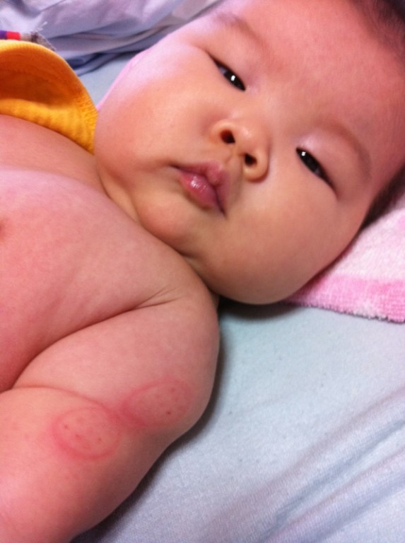 予防接種 g ３ヶ月１５日 日記 こっとちゃんさんのブログ 妊娠 出産 育児に関する総合情報サイト ベビカム