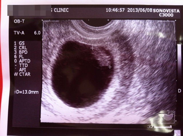 赤ちゃん見えた １才９ヶ月２０日 ８w０d 日記 こっとちゃんさんのブログ 妊娠 出産 育児に関する総合情報サイト ベビカム