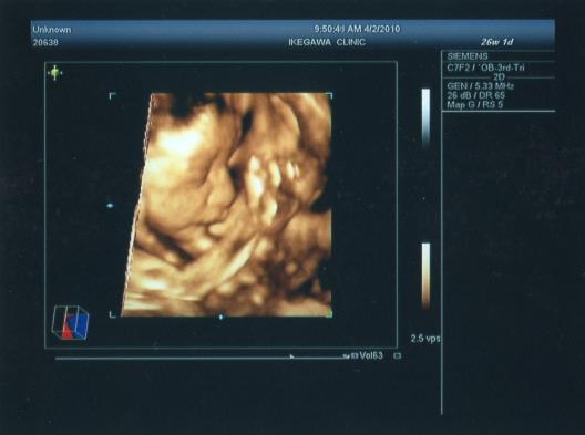 健診 ７ヶ月２６週１日 日記 めみんさんのブログ 妊娠 出産 育児に関する総合情報サイト ベビカム