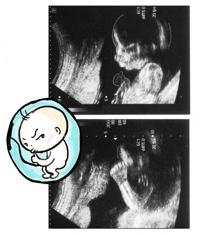 週横顔のエコー写真 日記 Yoyoyonさんのブログ 妊娠 出産 育児に関する総合情報サイト ベビカム