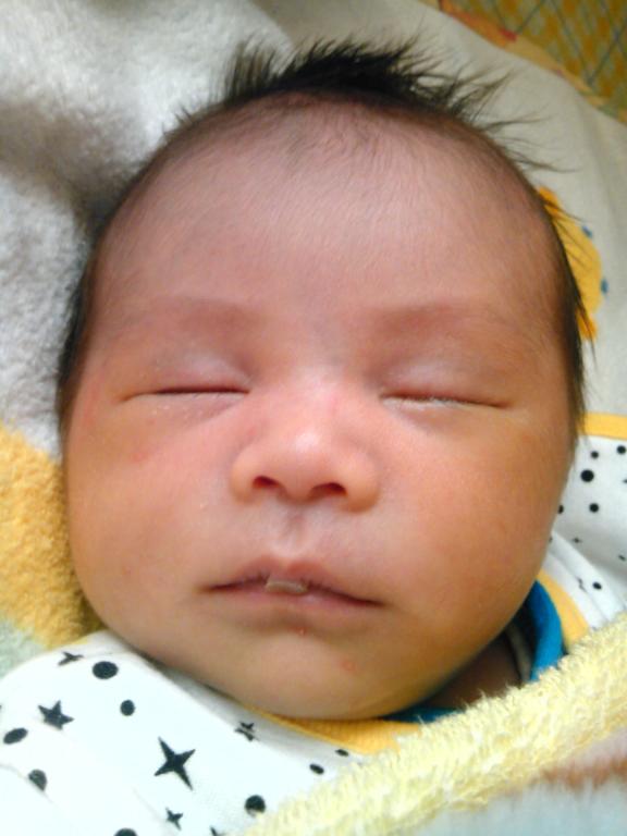 上唇の皮 日記 さくすけさんのブログ 妊娠 出産 育児に関する総合情報サイト ベビカム 上唇の皮 日記 さくすけさんのブログ 妊娠 出産 育児に関する総合情報サイト ベビカム
