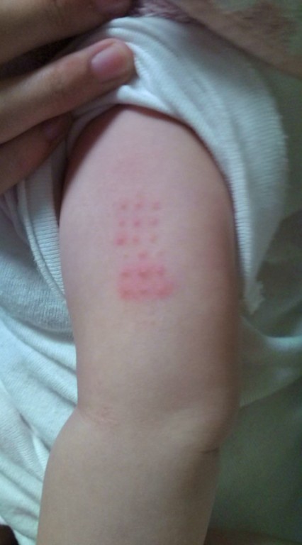 ｂｃｇいってきました 日記 めぐ８さんのブログ 妊娠 出産 育児に関する総合情報サイト ベビカム