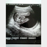 健診の楽しみ エコー写真 日記 妊娠特集さんのブログ 妊娠 出産 育児に関する総合情報サイト ベビカム