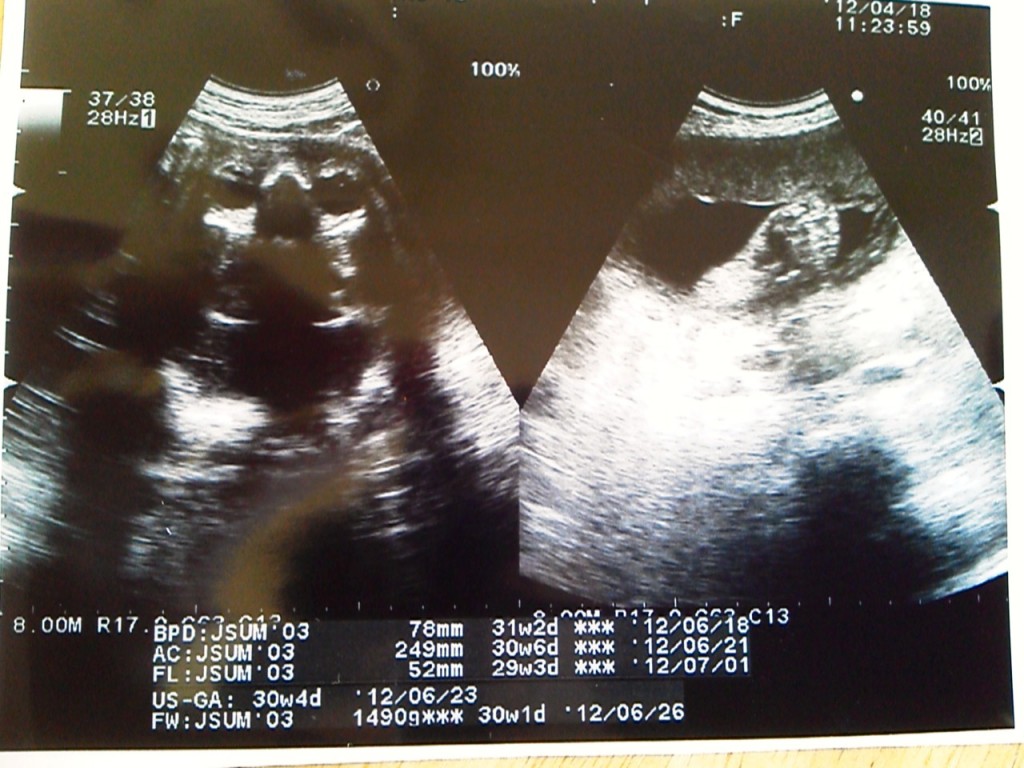 29週目 妊婦健診 日記 ゆかにぃさんのブログ 妊娠 出産 育児に関する総合情報サイト ベビカム