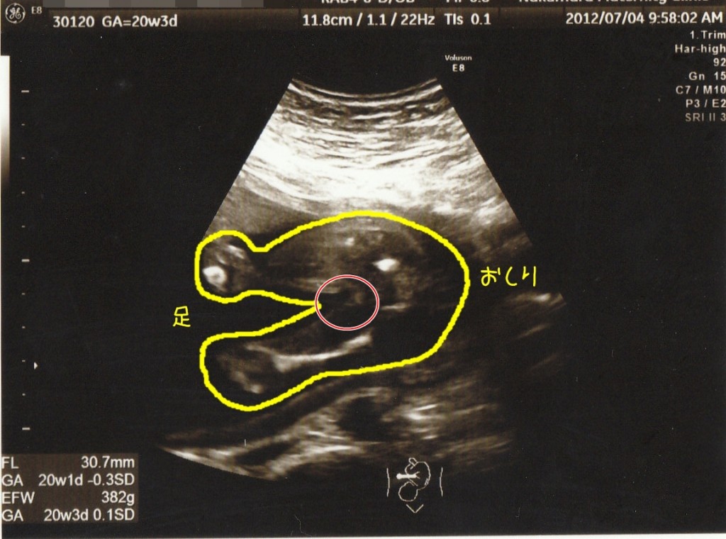 性別診断 日記 O0mai0oさんのブログ 妊娠 出産 育児に関する総合情報サイト ベビカム