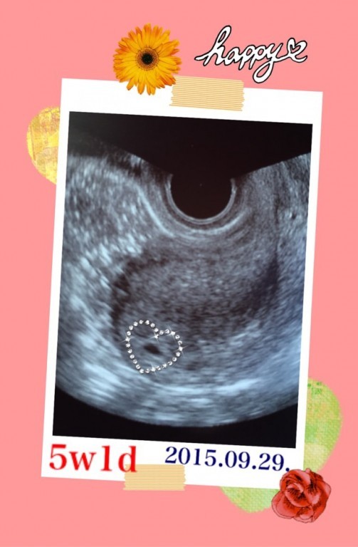 5w1d 病院に行ってきました 日記 Zh瑞香zhさんのブログ 妊娠 出産 育児に関する総合情報サイト ベビカム