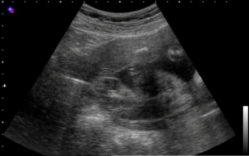 お腹ポンポン 6か月 日記 しずかなさんのブログ 妊娠 出産 育児に関する総合情報サイト ベビカム お腹ポンポン 6か月 日記 しずかなさんのブログ 妊娠 出産 育児に関する総合情報サイト ベビカム