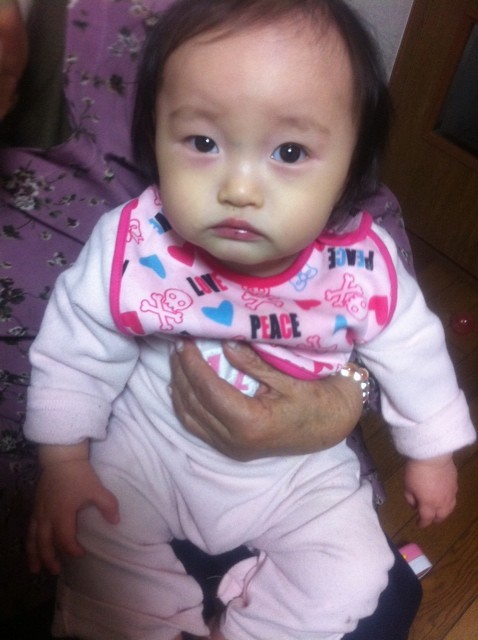 外斜視 涙 日記 ぴろ2さんのブログ 妊娠 出産 育児に関する総合情報サイト ベビカム