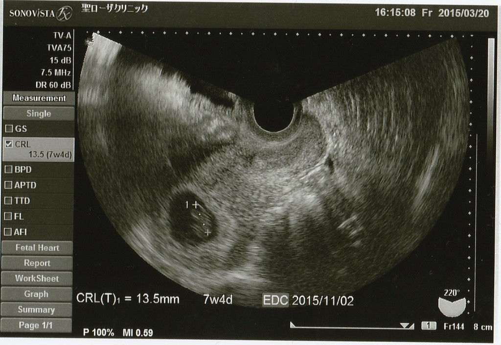 ｄ５９ 週数のズレ 日記 Utauta Yさんのブログ 妊娠 出産 育児に関する総合情報サイト ベビカム