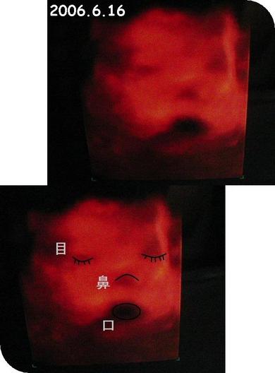 予定日超過後の初健診 日記 るびるびさんのブログ 妊娠 出産 育児に関する総合情報サイト ベビカム