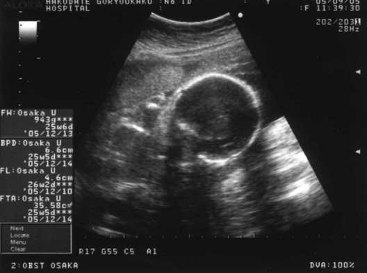 ２６週３日健診 日記 よしらんさんのブログ 妊娠 出産 育児に関する総合情報サイト ベビカム