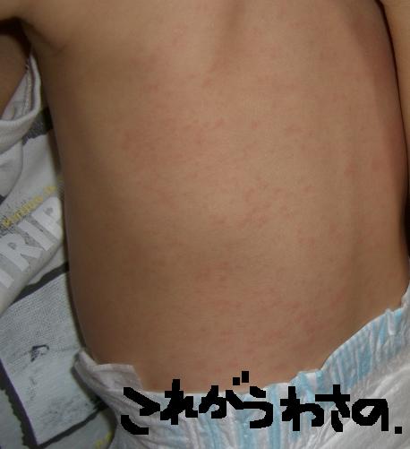 ついにきた 日記 Jun47さんのブログ 妊娠 出産 育児に関する総合情報サイト ベビカム