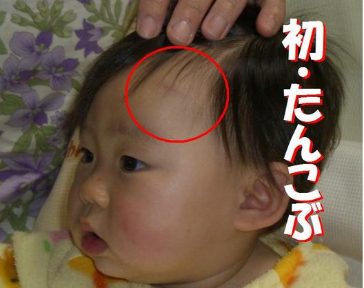 たんこぶできちゃった 日記 Jun47さんのブログ 妊娠 出産 育児に関する総合情報サイト ベビカム