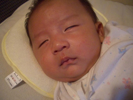 乳児性湿疹 日記 Nyankonyankoさんのブログ 妊娠 出産 育児に関する総合情報サイト ベビカム 乳児性湿疹 日記 Nyankonyankoさんのブログ 妊娠 出産 育児に関する総合情報サイト ベビカム