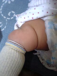 ボンレスハムな足 日記 こいんさんのブログ 妊娠 出産 育児に関する総合情報サイト ベビカム