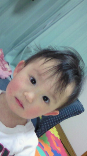 病み上がり ボツボツ 日記 たまひよっちさんのブログ 妊娠 出産 育児に関する総合情報サイト ベビカム