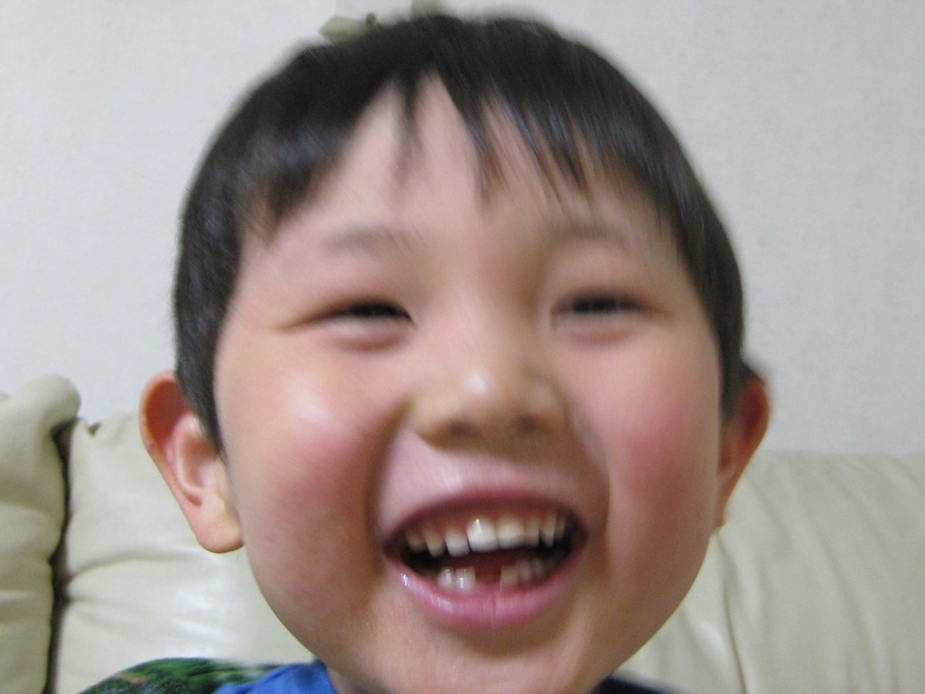 乳歯が抜けたよ 4歳9ヶ月 日記 かえる さといもさんのブログ 妊娠 出産 育児に関する総合情報サイト ベビカム