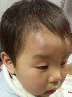 たんこぶ 日記 まてぃらさんのブログ 妊娠 出産 育児に関する総合情報サイト ベビカム